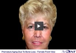Premature Aging Due<br></noscript> to Bone Loss - Female
